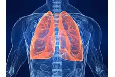 Aort Anevrizması Ameliyatı Sonrası Komplikasyonlar