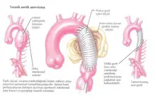 Arkus Aorta Bölümleri